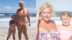 Mom explains stretch marks to her daughter.
