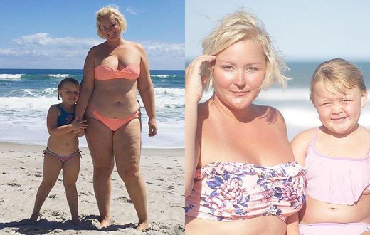 Mom explains stretch marks to her daughter.