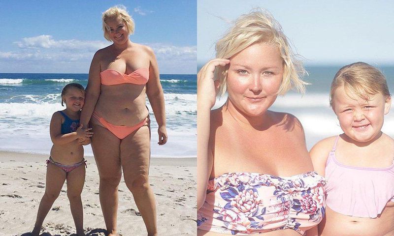 Mom explains stretch marks to her daughter.