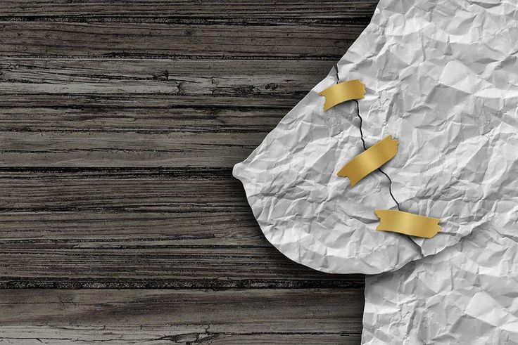 ___6601846___https:______static.pulse.com.gh___webservice___escenic___binary___6601846___2017___4___29___13___mastectomy