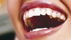 12 Things Your Dentist Knows About You Just By Looking in Your Mouth