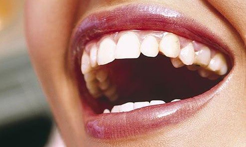 12 Things Your Dentist Knows About You Just By Looking in Your Mouth