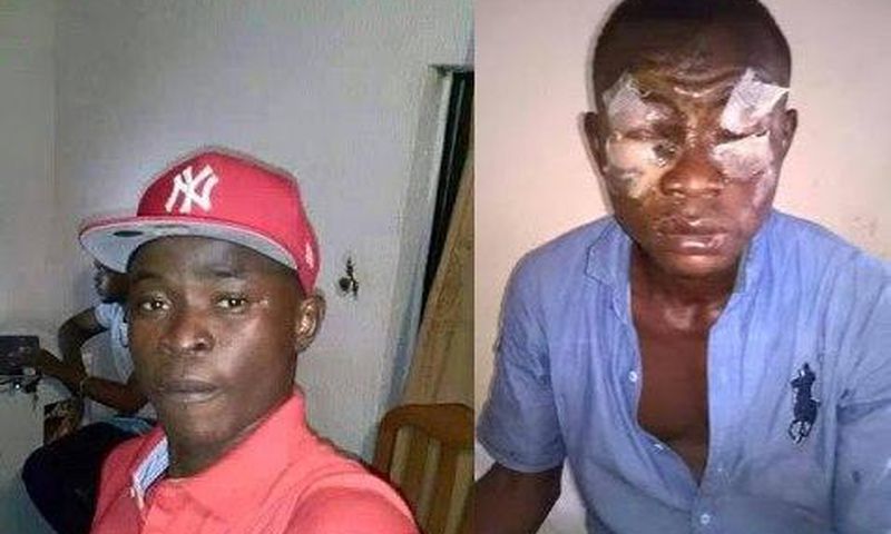 Before and after photo of the victim