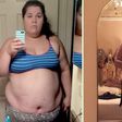 '9 things I wish I knew about gastric bypass surgery before I had it’