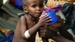 The study led by the African Union and backed by U.N. aid agencies and the African Development Bank noted consequences of stunting (low height for age) are of particular concern.