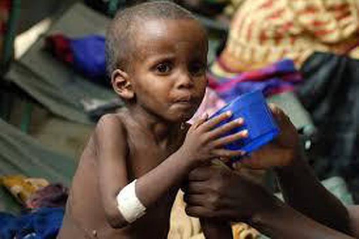 The study led by the African Union and backed by U.N. aid agencies and the African Development Bank noted consequences of stunting (low height for age) are of particular concern.