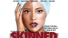 "Skinned" movie trailer