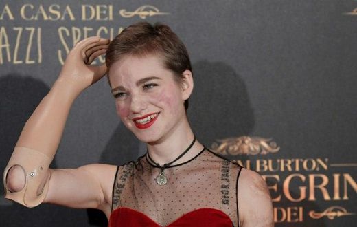 Fencing champion's Italian Beatrice Vio had been fencing since the age of five before a bout of meningitis cost her her two forearms and both legs