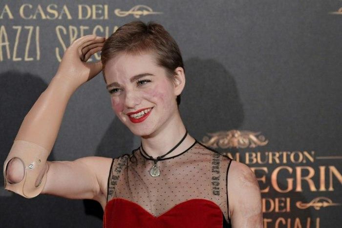 Fencing champion's Italian Beatrice Vio had been fencing since the age of five before a bout of meningitis cost her her two forearms and both legs