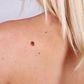 skin cancer causes surprising
