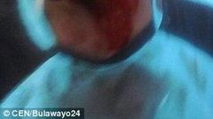 Mushonga came around bleeding heavily from his head