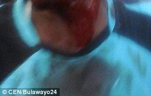 Mushonga came around bleeding heavily from his head