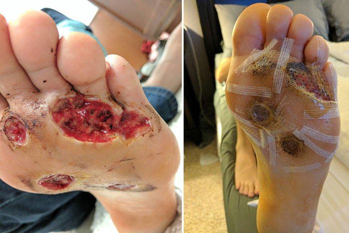 ___6688827___https:______static.pulse.com.gh___webservice___escenic___binary___6688827___2017___5___16___19___man-foot-fungus-barefoot-shower-at-gym