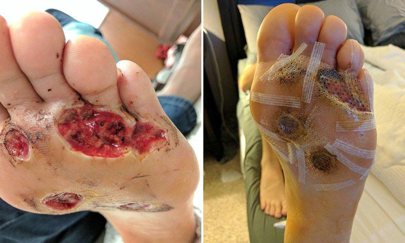 ___6688827___https:______static.pulse.com.gh___webservice___escenic___binary___6688827___2017___5___16___19___man-foot-fungus-barefoot-shower-at-gym
