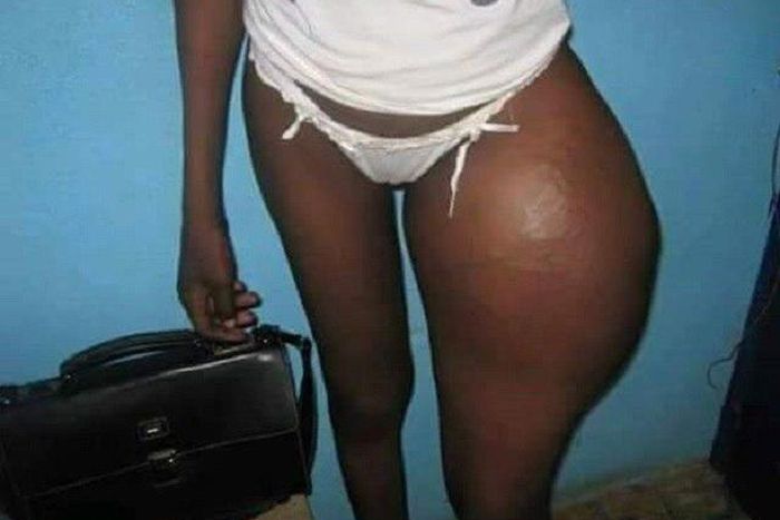 This lady got it all wrong when she went for a vagina enlargement