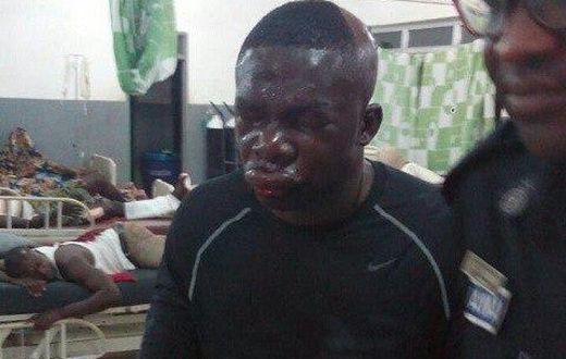 Police officer beaten by robbers