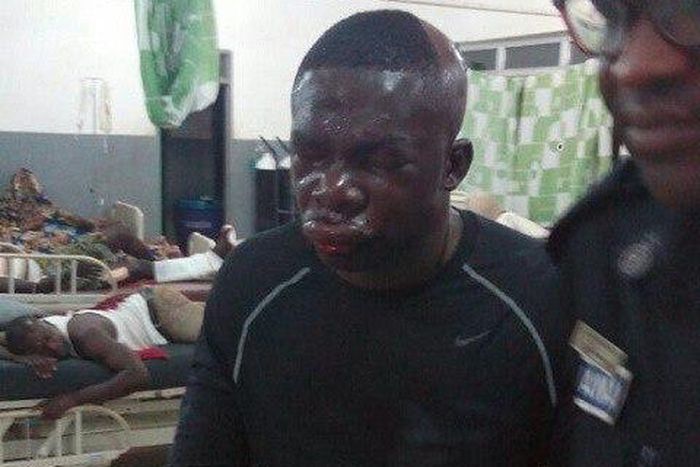 Police officer beaten by robbers