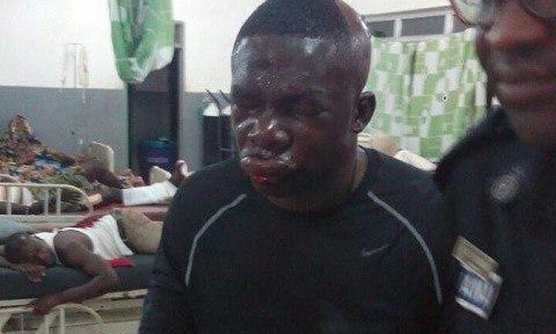 Police officer beaten by robbers