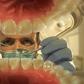 7 dentists share the most horrifying things they’ve ever seen at work