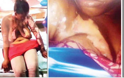 The two fighters, Biliki and Muyibat on their hospital beds