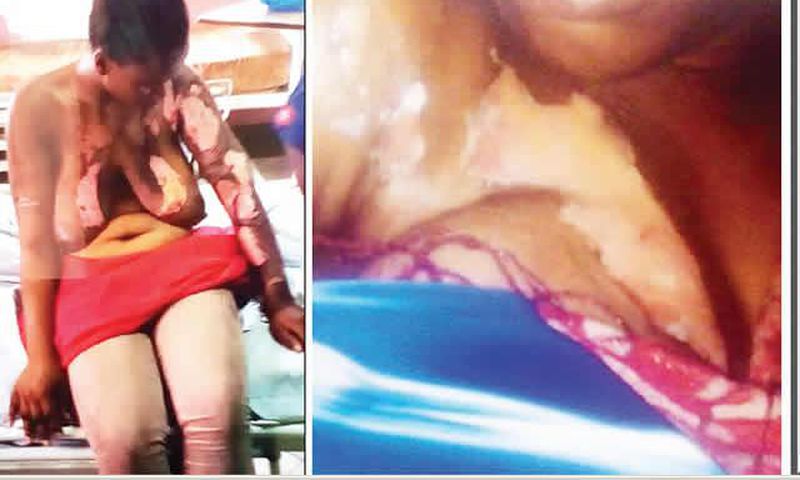 The two fighters, Biliki and Muyibat on their hospital beds