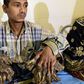 ‘Tree Man’ has surgery to remove bark-like warts on his hands