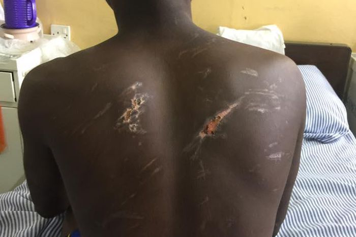 Victim shows injuries on his body. (Picture credit: Lawyer Francis Xavier Sosu)