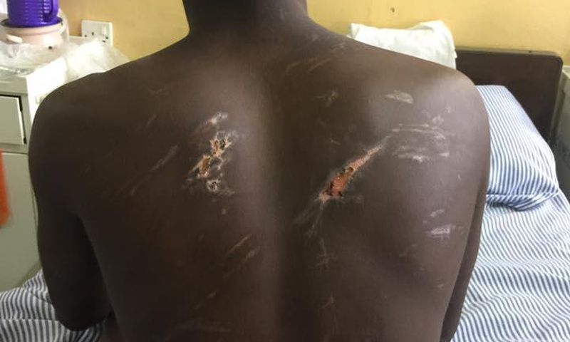 Victim shows injuries on his body. (Picture credit: Lawyer Francis Xavier Sosu)