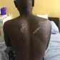 Victim shows injuries on his body. (Picture credit: Lawyer Francis Xavier Sosu)