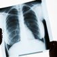 This Is Why Men Need to Be Screened For Lung Cancer More Than Women