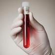 Could a simple blood test determine when you’ll die?