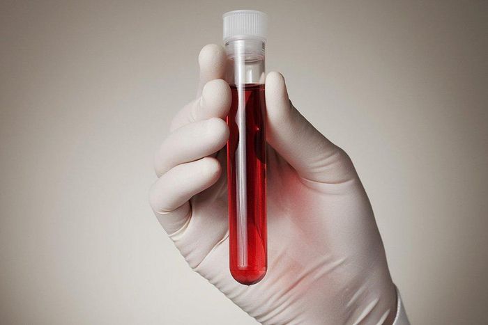 Could a simple blood test determine when you’ll die?