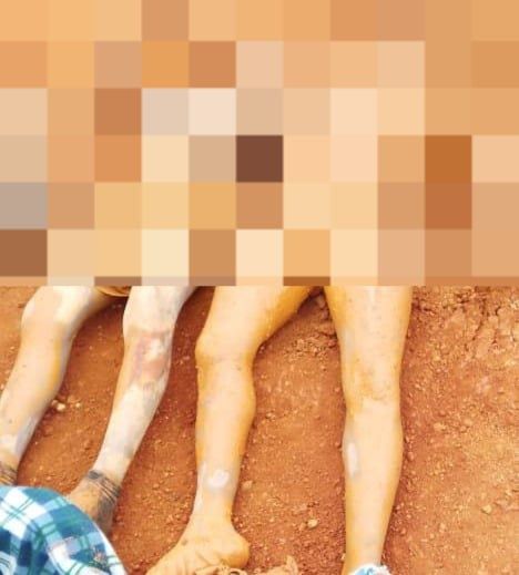 A/R: At least 5 dead, 4 rescued in galamsey pit collapse at Atwima Mponua district
