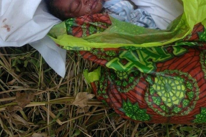 Abandoned baby found with "super glue" sealed lips