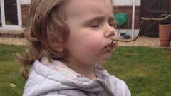 Toddler with rare condition eats paint, carpet, washing powder, stones and ants