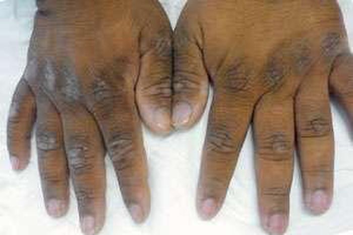 ___4541510___https:______static.pulse.com.gh___webservice___escenic___binary___4541510___2016___1___10___11___dark-knuckles