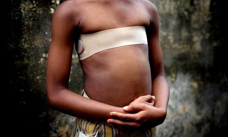 Hundreds of British mums are thought to have 'breast-ironed' their daughters