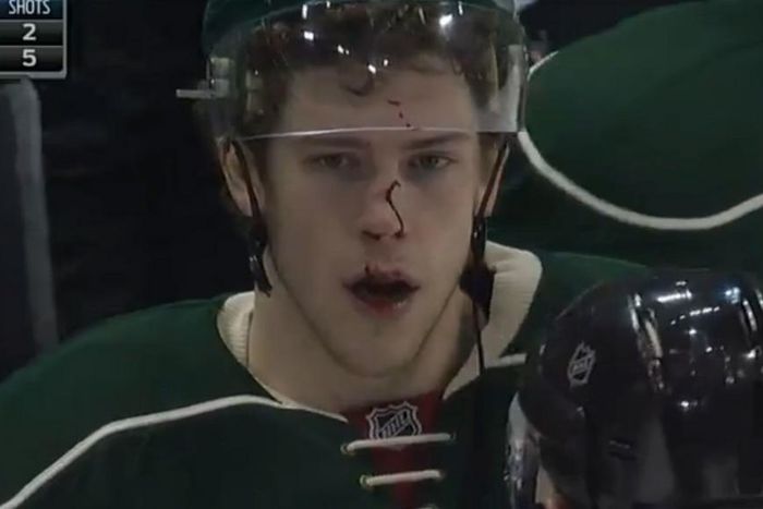 ___4859676___https:______static.pulse.com.gh___webservice___escenic___binary___4859676___2016___3___30___8___charlie-coyle-032916-getty-ftr-usjpg_2k35ux8xoao71f6g7twp0h5yh_2