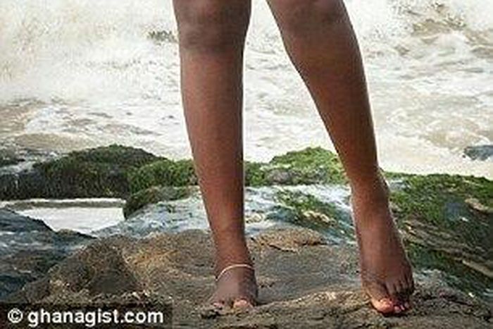 Princess Shyngle battles with kidney disease