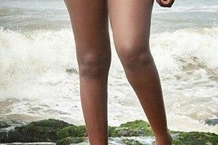 Princess Shyngle battles with kidney disease
