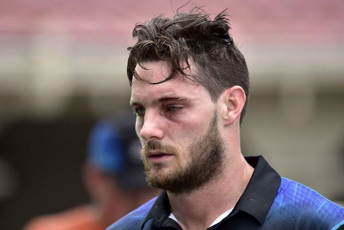 ___4616315___https:______static.pulse.com.gh___webservice___escenic___binary___4616315___2016___2___4___14___mitchellmcclenaghan-cropped_25hxe9pdfg5r13xpjaj6pxl7l