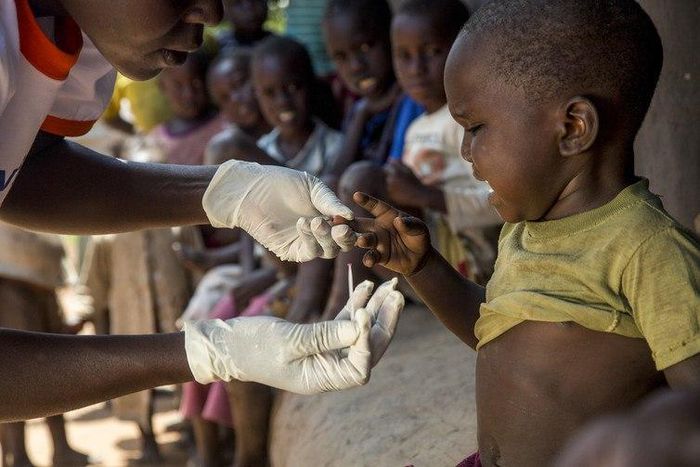 A boy in Busia, Western Kenya, has a rapid diagnostic malaria test