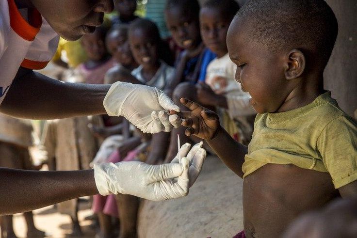 A boy in Busia, Western Kenya, has a rapid diagnostic malaria test