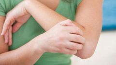 File photo: Woman with itchy skin