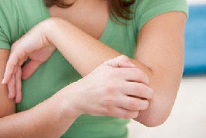 File photo: Woman with itchy skin