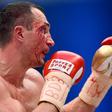 ___4730863___https:______static.pulse.com.gh___webservice___escenic___binary___4730863___2016___2___26___10___wladimirklitschko-cropped_9i9qhkzonho81bvk67vqyx04c