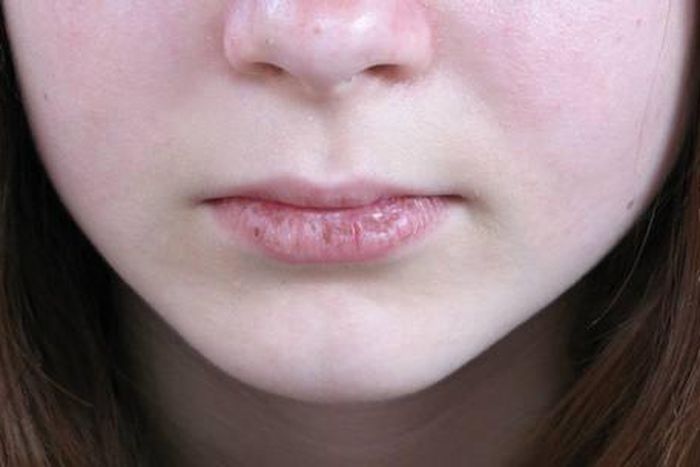 ___4637780___https:______static.pulse.com.gh___webservice___escenic___binary___4637780___2016___2___2___16___chapped-lips-ft