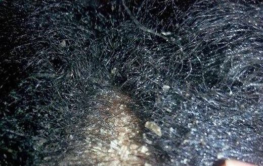 ___4631401___https:______static.pulse.com.gh___webservice___escenic___binary___4631401___2016___2___1___13___dandruff-3