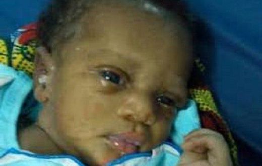 The Cameroon baby