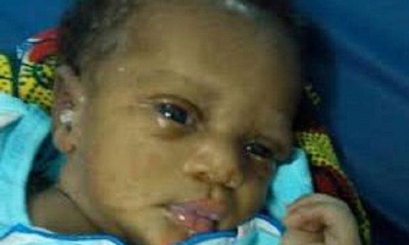 The Cameroon baby